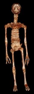 Momie de Nazca. Tomographie d'Albert.